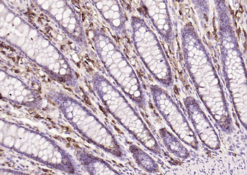CD138 Recombinant Rabbit Monoclonal Antibody
