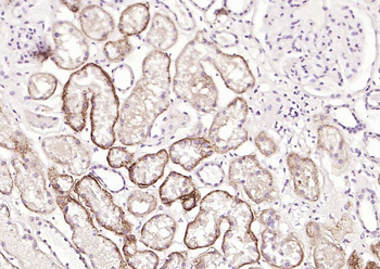 CD138 Recombinant Rabbit Monoclonal Antibody