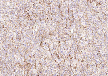 CD138 Recombinant Rabbit Monoclonal Antibody