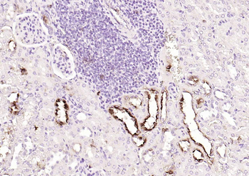 CD138 Recombinant Rabbit Monoclonal Antibody