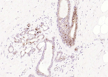STAT5A Recombinant Rabbit Monoclonal Antibody