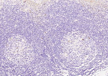 STAT5A Recombinant Rabbit Monoclonal Antibody