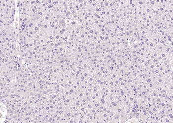 MYH1 Rabbit Polyclonal Antibody