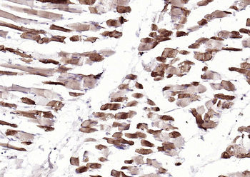 MYH1 Rabbit Polyclonal Antibody