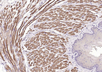 MYH1 Rabbit Polyclonal Antibody