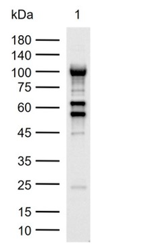 Adenovirus Rabbit Polyclonal Antibody