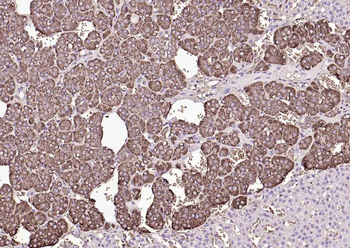 CHGA Rabbit Polyclonal Antibody