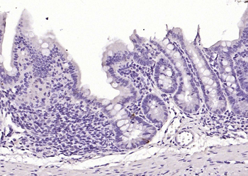 CHGA Rabbit Polyclonal Antibody