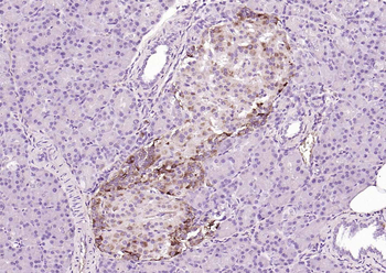 CHGA Rabbit Polyclonal Antibody