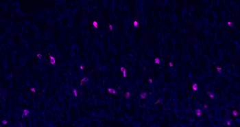 CHGA Rabbit Polyclonal Antibody