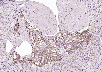 CHGA Rabbit Polyclonal Antibody