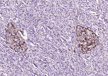 CHGA Rabbit Polyclonal Antibody