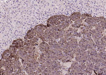 CHGA Rabbit Polyclonal Antibody