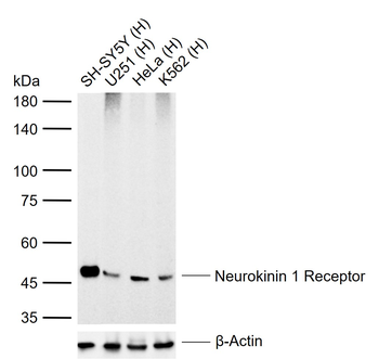 Neurokinin 1 Receptor Recombinant Rabbit Monoclonal Antibody