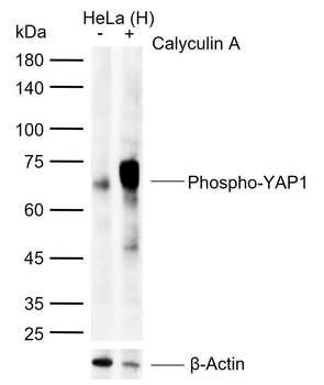 Phospho-YAP1 (Ser127) Recombinant Rabbit Monoclonal Antibody