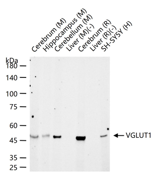 VGLUT1 Recombinant Rabbit Monoclonal Antibody