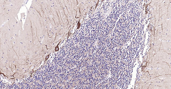 NEFH Recombinant Rabbit Monoclonal Antibody