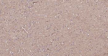 NEFH Recombinant Rabbit Monoclonal Antibody