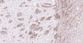 NEFH Recombinant Rabbit Monoclonal Antibody