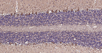 NEFH Recombinant Rabbit Monoclonal Antibody