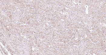 NEFH Recombinant Rabbit Monoclonal Antibody