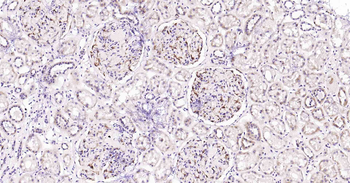 VEGFA Recombinant Rabbit Monoclonal Antibody
