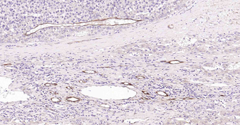VEGFA Recombinant Rabbit Monoclonal Antibody