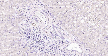 VEGFA Recombinant Rabbit Monoclonal Antibody