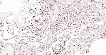VEGFA Recombinant Rabbit Monoclonal Antibody