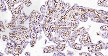 VEGFA Recombinant Rabbit Monoclonal Antibody