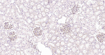 VEGFA Recombinant Rabbit Monoclonal Antibody
