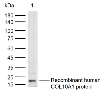 Collagen X Rabbit Polyclonal Antibody