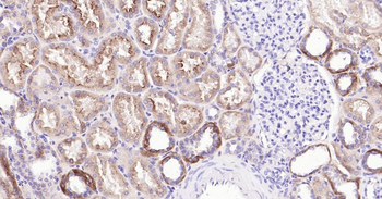 LRP2 Recombinant Rabbit Monoclonal Antibody