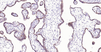 LRP2 Recombinant Rabbit Monoclonal Antibody