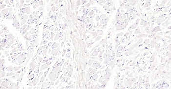 LRP2 Recombinant Rabbit Monoclonal Antibody