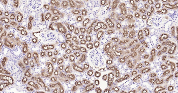 LRP2 Recombinant Rabbit Monoclonal Antibody