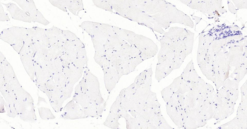 LRP2 Recombinant Rabbit Monoclonal Antibody
