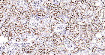 LRP2 Recombinant Rabbit Monoclonal Antibody