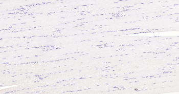 LRP2 Recombinant Rabbit Monoclonal Antibody