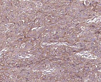 TROP2 Mouse Monoclonal Antibody