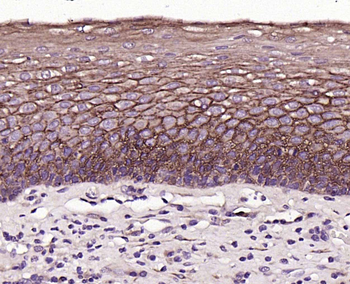 TROP2 Mouse Monoclonal Antibody