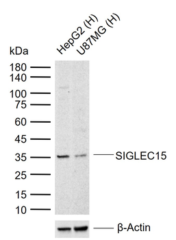 SIGLEC15 Mouse Monoclonal Antibody