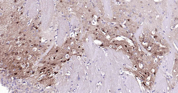 Beclin 1 Recombinant Rabbit Monoclonal Antibody