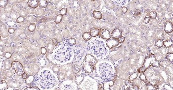 Beclin 1 Recombinant Rabbit Monoclonal Antibody