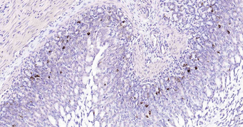 Beclin 1 Recombinant Rabbit Monoclonal Antibody