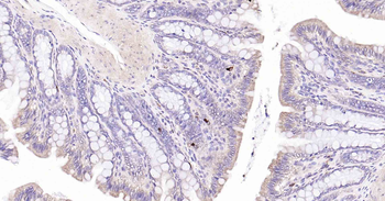 Beclin 1 Recombinant Rabbit Monoclonal Antibody