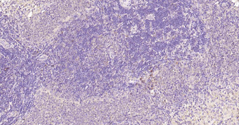 Beclin 1 Recombinant Rabbit Monoclonal Antibody