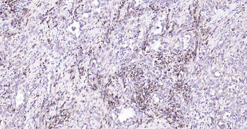 Beclin 1 Recombinant Rabbit Monoclonal Antibody