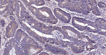 Beclin 1 Recombinant Rabbit Monoclonal Antibody