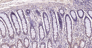 Beclin 1 Recombinant Rabbit Monoclonal Antibody